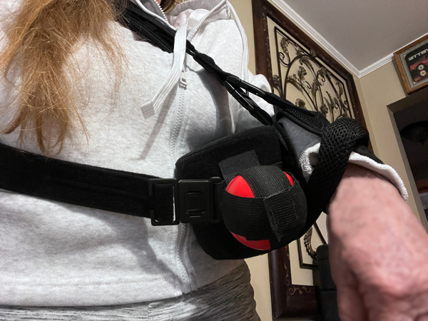 Karen Duquette's arm in a sling