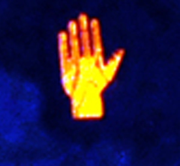 cut off hand
